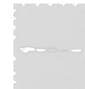 Western blot analysis of Jurkat HEPG2 and Hela cell Human testis tissue 231 cell lysates  using CECR5 Polyclonal Antibody at dilution of 1:650