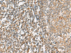 Immunohistochemistry of paraffin-embedded Human tonsil tissue  using CHKA Polyclonal Antibody at dilution of 1:35(×200)