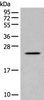 Western blot analysis of Human placenta tissue lysate  using CARD16 Polyclonal Antibody at dilution of 1:800