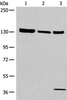 Western blot analysis of 293T cell Human testis tissue lysate A549 cell lysates  using EPHA6 Polyclonal Antibody at dilution of 1:800