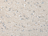 Immunohistochemistry of paraffin-embedded Human brain tissue  using UCN3 Polyclonal Antibody at dilution of 1:55(×200)