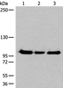 Western blot analysis of Hela K562 and HEPG2 cell lysates  using XPO1 Polyclonal Antibody at dilution of 1:200