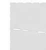 Western blot analysis of Human breast cancer tissue TM4 231 and Jurkat cell lysates  using OTUD6A Polyclonal Antibody at dilution of 1:550