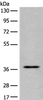 Western blot analysis of Jurkat cell lysate  using EN2 Polyclonal Antibody at dilution of 1:400