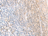 Immunohistochemistry of paraffin-embedded Human tonsil tissue  using EPSTI1 Polyclonal Antibody at dilution of 1:25(×200)