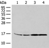 Western blot analysis of 293T and K562 cell Human between peritoneal stromal sarcoma tissue HEPG2 cell lysates  using MYDGF Polyclonal Antibody at dilution of 1:250