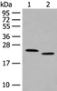 Western blot analysis of Human fat tissue and A375 cell lysates  using FAM213A Polyclonal Antibody at dilution of 1:400