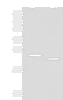 Western blot analysis of Human fat tissue and A375 cell lysates  using FAM213A Polyclonal Antibody at dilution of 1:400