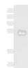 Western blot analysis of Human colorectal cancer tissue lysate  using METTL17 Polyclonal Antibody at dilution of 1:700