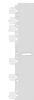 Western blot analysis of Human placenta tissue lysate  using FCGRT Polyclonal Antibody at dilution of 1:400