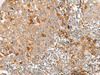 Immunohistochemistry of paraffin-embedded Human tonsil tissue  using RNF207 Polyclonal Antibody at dilution of 1:40(×200)