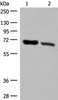 Western blot analysis of Human placenta tissue and Human fetal brain tissue lysates  using TRIM8 Polyclonal Antibody at dilution of 1:500