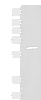 Western blot analysis of Mouse liver tissue lysate  using GLS2 Polyclonal Antibody at dilution of 1:400