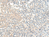 Immunohistochemistry of paraffin-embedded Human tonsil tissue  using GPR161 Polyclonal Antibody at dilution of 1:40(×200)