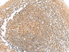 Immunohistochemistry of paraffin-embedded Human tonsil tissue  using GRHPR Polyclonal Antibody at dilution of 1:35(×200)