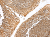 Immunohistochemistry of paraffin-embedded Human tonsil tissue  using GRSF1 Polyclonal Antibody at dilution of 1:30(×200)