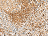 Immunohistochemistry of paraffin-embedded Human tonsil tissue  using HLA-DPA1 Polyclonal Antibody at dilution of 1:35(×200)