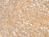 Immunohistochemistry of paraffin-embedded Human tonsil tissue  using HMBOX1 Polyclonal Antibody at dilution of 1:30(×200)