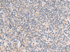 Immunohistochemistry of paraffin-embedded Human tonsil tissue  using IDUA Polyclonal Antibody at dilution of 1:35(×200)
