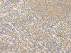 Immunohistochemistry of paraffin-embedded Human tonsil tissue  using IP6K3 Polyclonal Antibody at dilution of 1:50(×200)