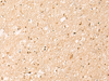 Immunohistochemistry of paraffin-embedded Human brain tissue  using IL1RAPL2 Polyclonal Antibody at dilution of 1:25(×200)