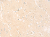 Immunohistochemistry of paraffin-embedded Human brain tissue  using IL37 Polyclonal Antibody at dilution of 1:50(×200)