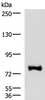 Western blot analysis of TM4 cell lysate  using FOXK2 Polyclonal Antibody at dilution of 1:1000