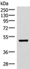 Western blot analysis of Mouse brain tissue lysate  using IP6K2 Polyclonal Antibody at dilution of 1:500