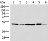 Western blot analysis of Jurkat PC-3 HepG2 Hela HT-29 and Raji cell lysates  using IP6K1 Polyclonal Antibody at dilution of 1:400