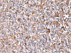 Immunohistochemistry of paraffin-embedded Human tonsil tissue  using IP6K1 Polyclonal Antibody at dilution of 1:40(×200)