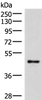 Western blot analysis of Mouse lung tissue lysate  using IRX2 Polyclonal Antibody at dilution of 1:300