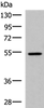 Western blot analysis of HepG2 cell lysate  using ISM1 Polyclonal Antibody at dilution of 1:1000