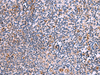 Immunohistochemistry of paraffin-embedded Human tonsil tissue  using ITGA11 Polyclonal Antibody at dilution of 1:75(×200)