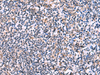 Immunohistochemistry of paraffin-embedded Human tonsil tissue  using NMRK2 Polyclonal Antibody at dilution of 1:55(×200)