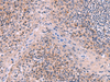 Immunohistochemistry of paraffin-embedded Human tonsil tissue  using ITIH4 Polyclonal Antibody at dilution of 1:50(×200)