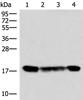 Western blot analysis of 293T and 231 cell lysates  using PEMT Polyclonal Antibody at dilution of 1:800