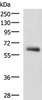 Western blot analysis of Human metastatic papillary carcinoma(thyroid cancer) tissue lysate  using KBTBD11 Polyclonal Antibody at dilution of 1:2300