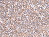 Immunohistochemistry of paraffin-embedded Human tonsil tissue  using SLC12A7 Polyclonal Antibody at dilution of 1:50(×200)