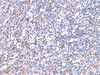 Immunohistochemistry of paraffin-embedded Human tonsil tissue  using KCNK10 Polyclonal Antibody at dilution of 1:45(×200)