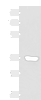 Western blot analysis of Human muscle tissue lysate  using KCNK15 Polyclonal Antibody at dilution of 1:1000