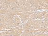 Immunohistochemistry of paraffin-embedded Human brain tissue  using KCTD7 Polyclonal Antibody at dilution of 1:55(×200)