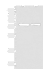 Western blot analysis of HepG2 and Hela cell lysates  using KHSRP Polyclonal Antibody at dilution of 1:1000