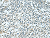 Immunohistochemistry of paraffin-embedded Human tonsil tissue  using SHTN1 Polyclonal Antibody at dilution of 1:60(×200)