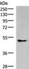 Western blot analysis of A549 cell lysate  using KCNJ2 Polyclonal Antibody at dilution of 1:550
