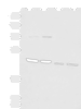 Western blot analysis of Rat brain tissue Mouse brain tissue Raji and 231 cell lysates  using HTRA2 Polyclonal Antibody at dilution of 1:1000
