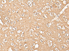 Immunohistochemistry of paraffin-embedded Human brain tissue  using ADORA3 Polyclonal Antibody at dilution of 1:30(×200)