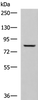 Western blot analysis of Human tongue tissue lysate  using TGM3 Polyclonal Antibody at dilution of 1:800