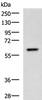 Western blot analysis of A549 cell lysate  using TERF1 Polyclonal Antibody at dilution of 1:400