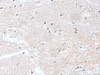 Immunohistochemistry of paraffin-embedded Human brain tissue  using CACNB1 Polyclonal Antibody at dilution of 1:100(×200)