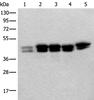 Western blot analysis of 293T Hela and HEPG2 cell lysates  using TIA1 Polyclonal Antibody at dilution of 1:250